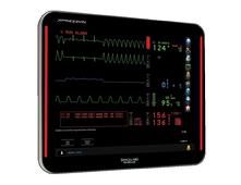 Spacelabs Xpresson Patient Monitoring System